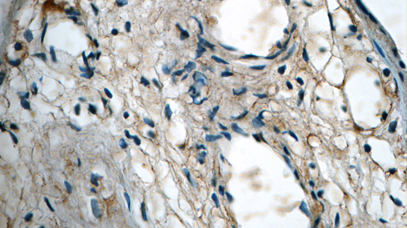 Immunohistochemistry of paraffin-embedded human placenta slide using Catalog No:113154(NFKB1 Antibody) at dilution of 1:50 (under 40x lens)