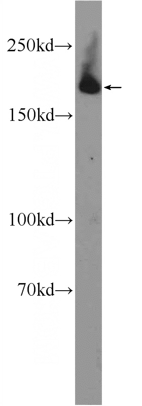 HEK-293 cells were subjected to SDS PAGE followed by western blot with Catalog No:112047(KIAA0368 Antibody) at dilution of 1:600