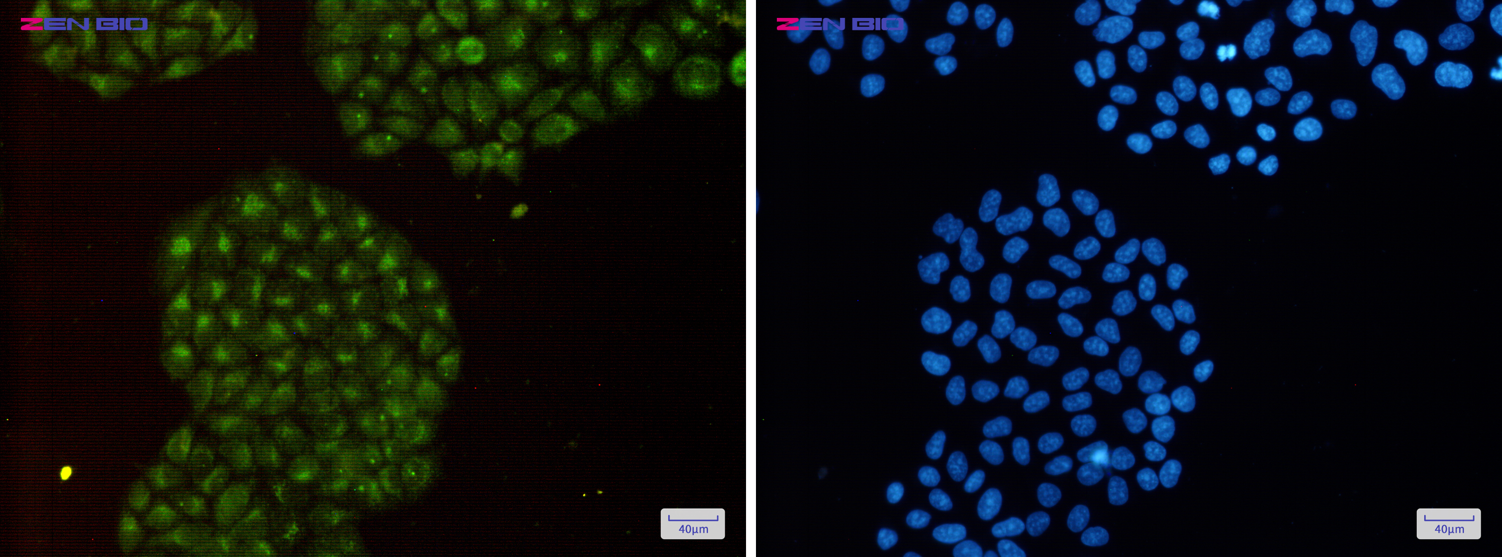 Immunocytochemistry of LMP7(green) in Hela cells using LMP7 Rabbit pAb at dilution 1/50, and DAPI(blue)