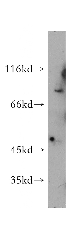 COS-7 cells were subjected to SDS PAGE followed by western blot with Catalog No:108228(ASH2L antibody) at dilution of 1:1000