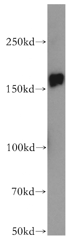 mouse testis tissue were subjected to SDS PAGE followed by western blot with Catalog No:115666(NCOA1 antibody) at dilution of 1:400