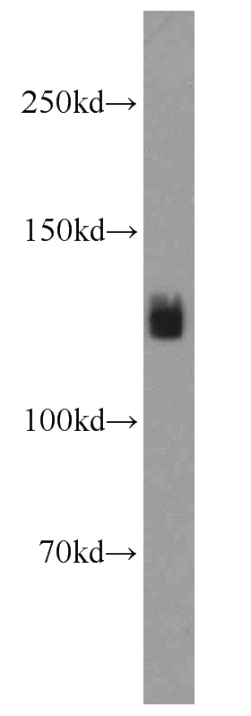 mouse brain tissue were subjected to SDS PAGE followed by western blot with Catalog No:111209(GRIP1 antibody) at dilution of 1:1000