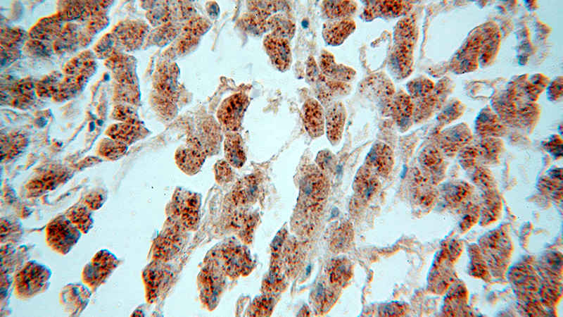 Immunohistochemical of paraffin-embedded human liver using Catalog No:113983(PNPO antibody) at dilution of 1:100 (under 40x lens)