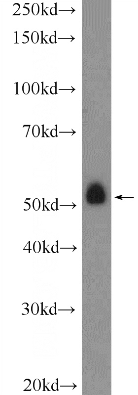 L02 cells were subjected to SDS PAGE followed by western blot with Catalog No:113119(NEU4 Antibody) at dilution of 1:1000