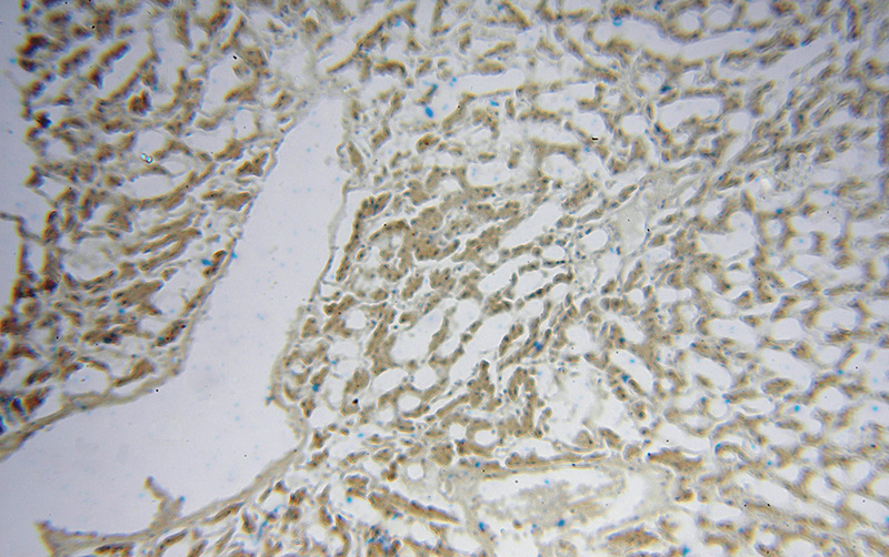 Immunohistochemical of paraffin-embedded human liver using Catalog No:113085(NDUFS7 antibody) at dilution of 1:100 (under 10x lens)