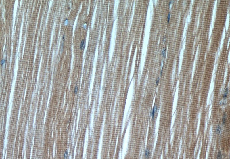 Immunohistochemical of paraffin-embedded human skeletal muscle using Catalog No:113566(PAMR1 antibody) at dilution of 1:50 (under 40x lens)