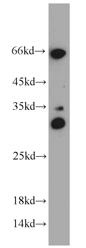 DU 145 cells were subjected to SDS PAGE followed by western blot with Catalog No:111308(HEY1 antibody) at dilution of 1:3000