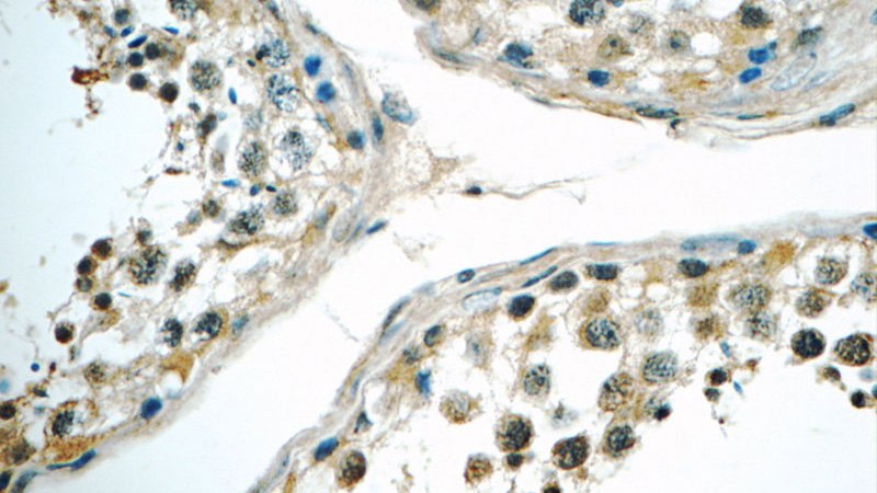 Immunohistochemistry of paraffin-embedded human testis tissue slide using Catalog No:115229(SIK1 Antibody) at dilution of 1:50 (under 40x lens)