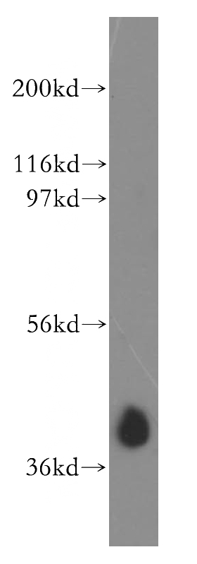 K-562 cells were subjected to SDS PAGE followed by western blot with Catalog No:117072(AUP1 antibody) at dilution of 1:400