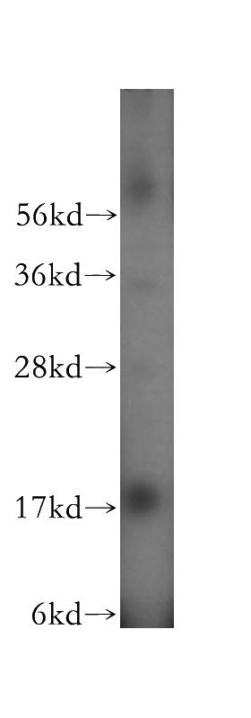 mouse uterus tissue were subjected to SDS PAGE followed by western blot with Catalog No:114828(RPS13 antibody) at dilution of 1:500