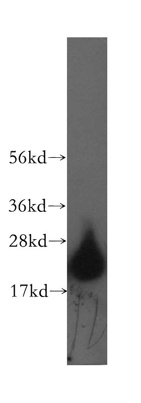human brain tissue were subjected to SDS PAGE followed by western blot with Catalog No:111445(HPCAL4 antibody) at dilution of 1:500