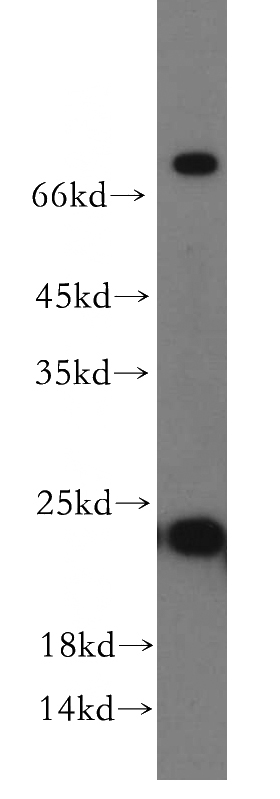 human brain tissue were subjected to SDS PAGE followed by western blot with Catalog No:114454(RAB5A-Specific antibody) at dilution of 1:500