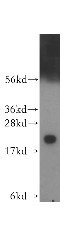 HeLa cells were subjected to SDS PAGE followed by western blot with Catalog No:108945(CBX3 antibody) at dilution of 1:500