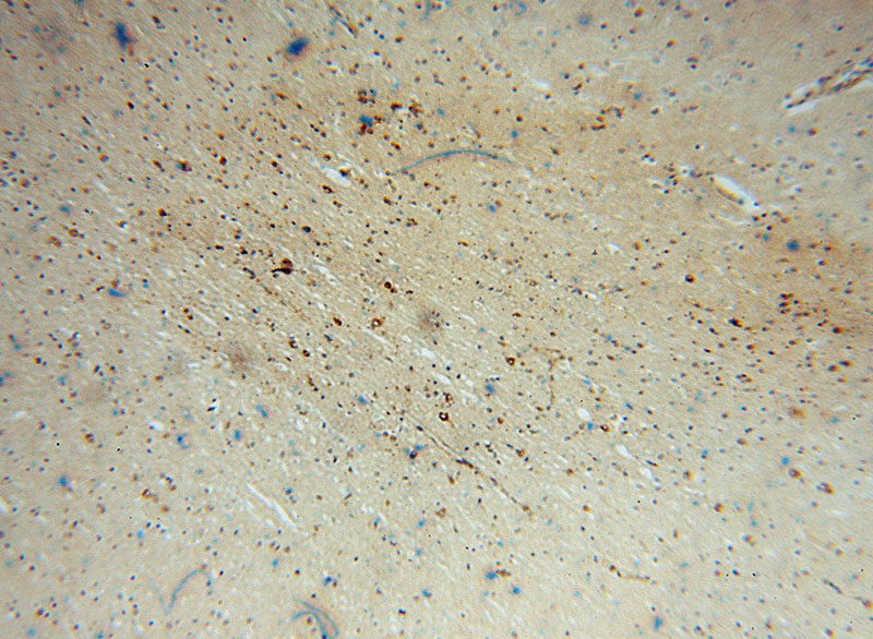 Immunohistochemical of paraffin-embedded human brain using Catalog No:115041(SACM1L antibody) at dilution of 1:100 (under 10x lens)