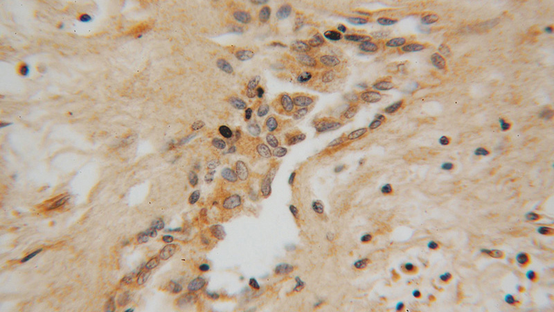 Immunohistochemical of paraffin-embedded human prostate using Catalog No:113249(NME5 antibody) at dilution of 1:100 (under 40x lens)