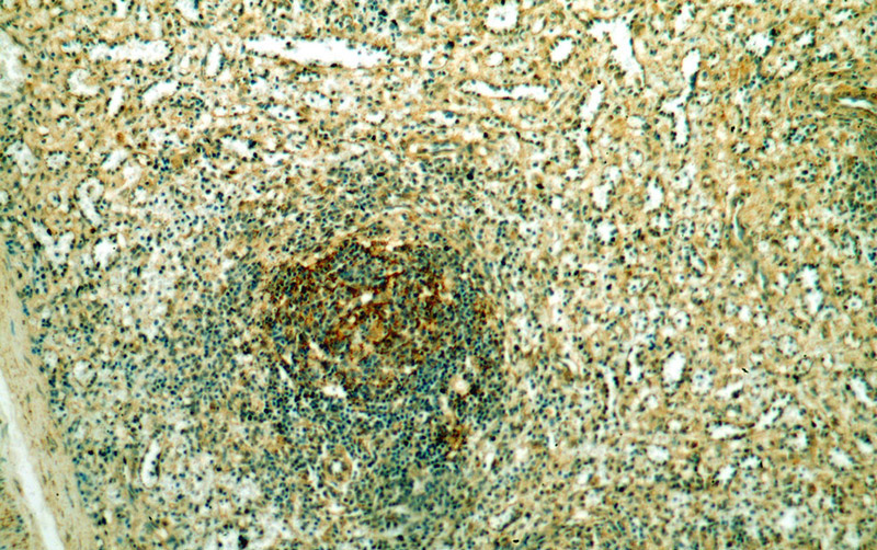 Immunohistochemical of paraffin-embedded human spleen using Catalog No:116290(TNFR2 antibody) at dilution of 1:50 (under 10x lens)