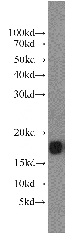 mouse brain tissue were subjected to SDS PAGE followed by western blot with Catalog No:110758(FXYD7 antibody) at dilution of 1:600