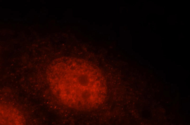 Immunofluorescent analysis of MCF-7 cells, using FAM107A antibody Catalog No:110458 at 1:25 dilution and Rhodamine-labeled goat anti-rabbit IgG (red).