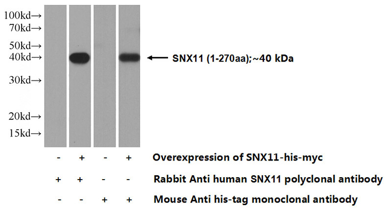 Transfected HEK-293 cells were subjected to SDS PAGE followed by western blot with Catalog No:115470(SNX11 Antibody) at dilution of 1:500