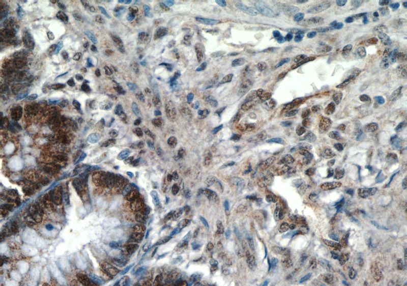 Immunohistochemistry of paraffin-embedded human colon tissue slide using Catalog No:112196(LEO1 Antibody) at dilution of 1:50 (under 40x lens)