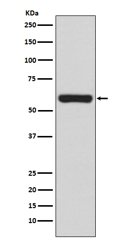 Western blot analysis of TRAF6 expression in Jurkat cell lysate.