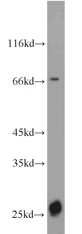 human brain tissue were subjected to SDS PAGE followed by western blot with Catalog No:113282(NRSN2 antibody) at dilution of 1:500