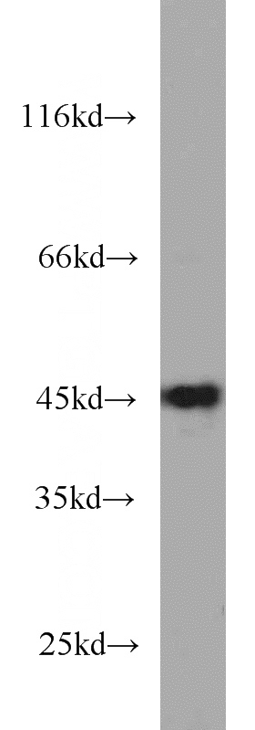 HEK-293 cells were subjected to SDS PAGE followed by western blot with Catalog No:113111(RDBP antibody) at dilution of 1:1000