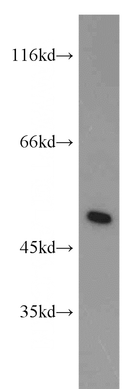 Jurkat cells were subjected to SDS PAGE followed by western blot with Catalog No:111837(IRF5 antibody) at dilution of 1:800