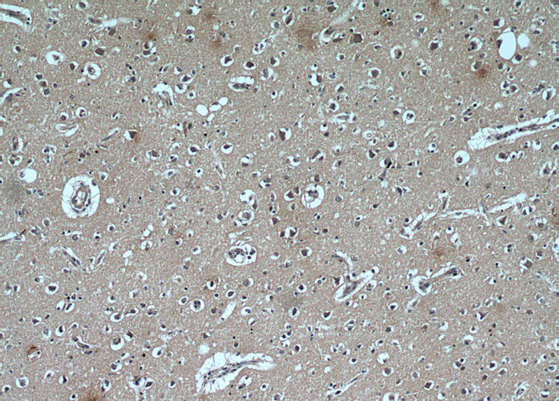 Immunohistochemical of paraffin-embedded human brain using Catalog No:108803(C9orf72 antibody) at dilution of 1:50 (under 10x lens)