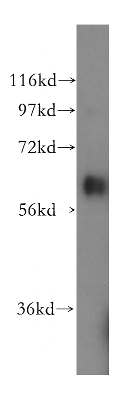 HeLa cells were subjected to SDS PAGE followed by western blot with Catalog No:116894(YTHDF1 antibody) at dilution of 1:500