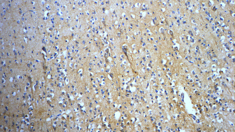 Immunohistochemistry of paraffin-embedded human brain slide using Catalog No:115972(TACR3 Antibody) at dilution of 1:50