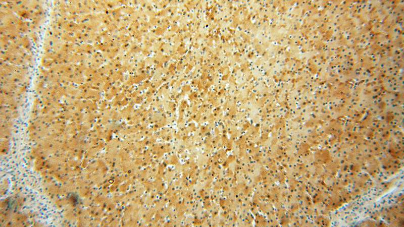 Immunohistochemical of paraffin-embedded human liver using Catalog No:115492(SOD1 antibody) at dilution of 1:100 (under 10x lens)