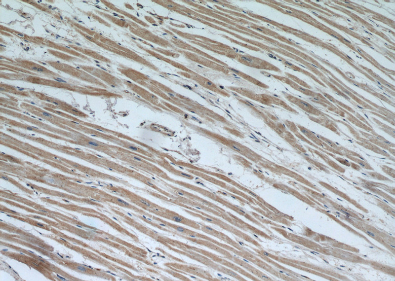 Immunohistochemical of paraffin-embedded human heart using Catalog No:113364(NUDT9 antibody) at dilution of 1:50 (under 10x lens)