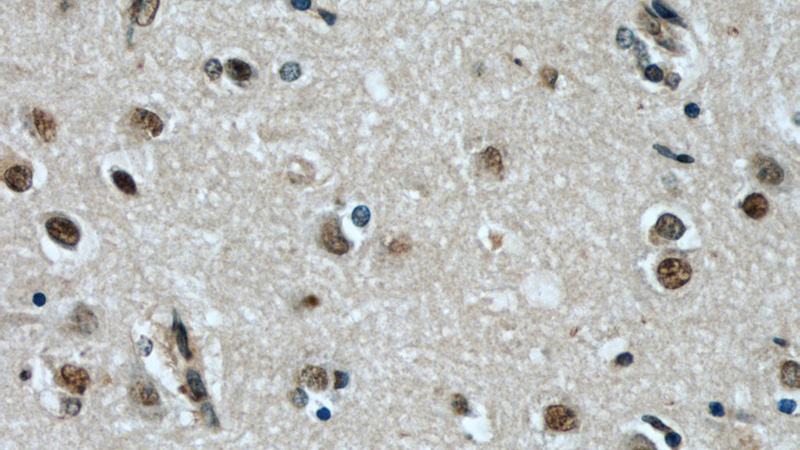 Immunohistochemical of paraffin-embedded human brain using Catalog No:110597(FAM71E2 antibody) at dilution of 1:50 (under 40x lens)
