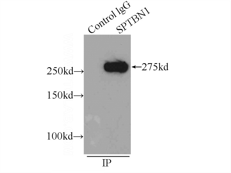 IP Result of anti-SPTBN1-Specific (IP:Catalog No:115653, 5ug; Detection:Catalog No:115653 1:600) with HEK-293 cells lysate 1000ug.
