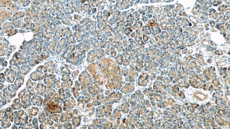 Immunohistochemical of paraffin-embedded human pancreas using Catalog No:107499(RBBP9 antibody) at dilution of 1:50 (under 10x lens)
