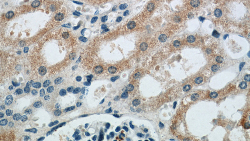 Immunohistochemical of paraffin-embedded human kidney using Catalog No:111491(HMOX1 antibody) at dilution of 1:50 (under 40x lens)
