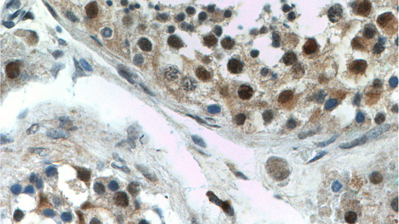 Immunohistochemistry of paraffin-embedded human testis tissue slide using Catalog No:111227(GTF2A1 Antibody) at dilution of 1:200 (under 40x lens).