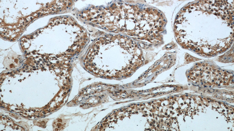 Immunohistochemical of paraffin-embedded human testis using Catalog No:109532(CPT1C antibody) at dilution of 1:50 (under 10x lens)