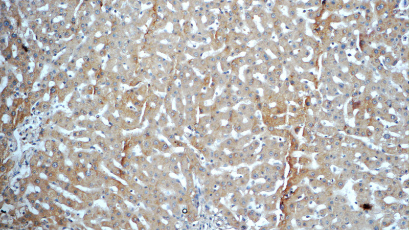 Immunohistochemistry of paraffin-embedded human liver tissue slide using Catalog No:107737(ACHE Antibody) at dilution of 1:50 (under 10x lens)