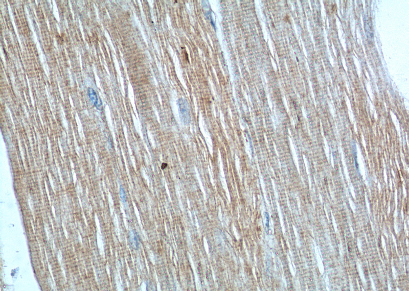 Immunohistochemistry of paraffin-embedded human skeletal muscle tissue slide using Catalog No:114315(PTPN11 Antibody) at dilution of 1:50 (under 40x lens)