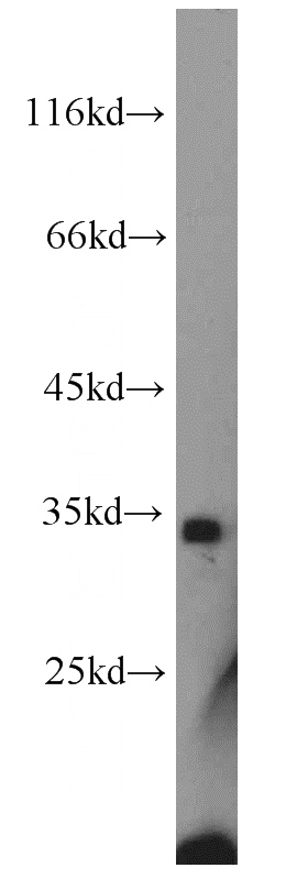 mouse colon tissue were subjected to SDS PAGE followed by western blot with Catalog No:113216(NPHS2 antibody) at dilution of 1:400