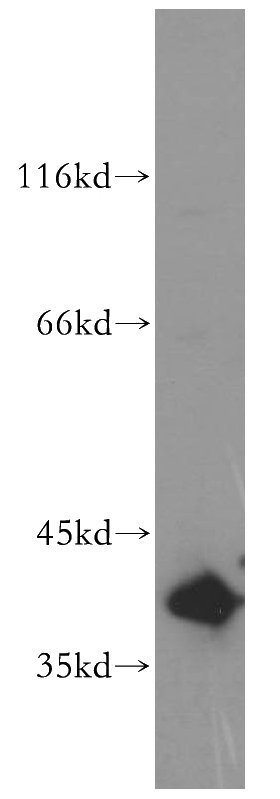 HeLa cells were subjected to SDS PAGE followed by western blot with Catalog No:113823(PHLDA1 antibody) at dilution of 1:500