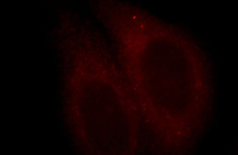 Immunofluorescent analysis of HepG2 cells, using CTAG1A antibody Catalog No:113457 at 1:25 dilution and Rhodamine-labeled goat anti-rabbit IgG (red).