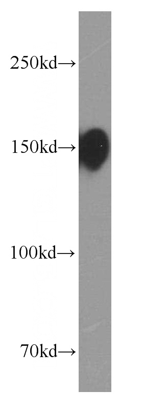 U-937 cells were subjected to SDS PAGE followed by western blot with Catalog No:107041(ANPEP Antibody) at dilution of 1:4000
