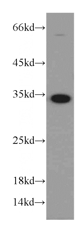 HeLa cells were subjected to SDS PAGE followed by western blot with Catalog No:112368(MAD2L1BP antibody) at dilution of 1:800