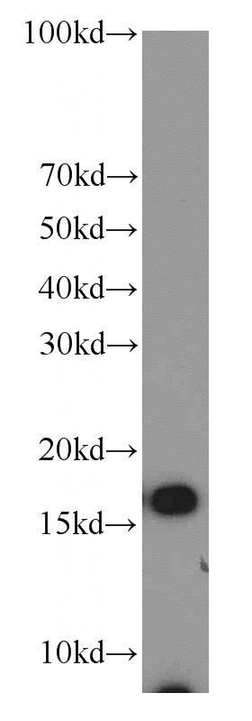 MCF7 cells were subjected to SDS PAGE followed by western blot with Catalog No:117309(COX4I2 antibody) at dilution of 1:1000