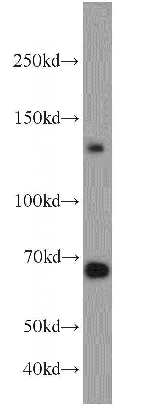 HeLa cells were subjected to SDS PAGE followed by western blot with Catalog No:108809(CDH20 antibody) at dilution of 1:1000