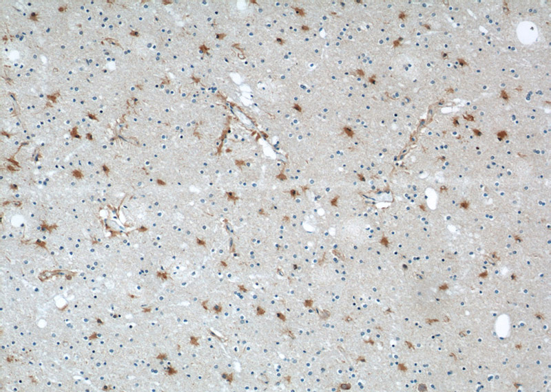 Immunohistochemical of paraffin-embedded human brain using Catalog No:110252(ENO1 antibody) at dilution of 1:100 (under 10x lens)