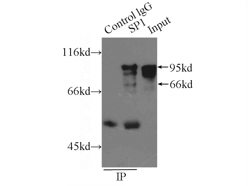 IP Result of anti-SP1 (IP:Catalog No:115521, 6ug; Detection:Catalog No:115521 1:500) with A431 cells lysate 2500ug.